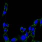 FAK Antibody